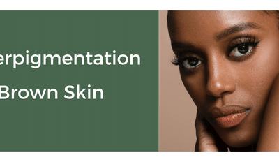 A Woman Looking At The Camera